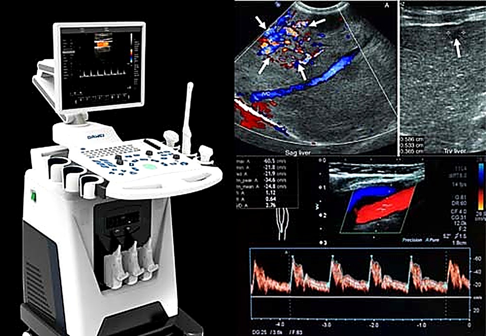 Doppler ultrasound at D.O.D. in Tegucigalpa, Honduras